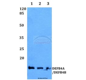 Anti-DEFB4 Antibody from Bioworld Technology (BS60360) - Antibodies.com