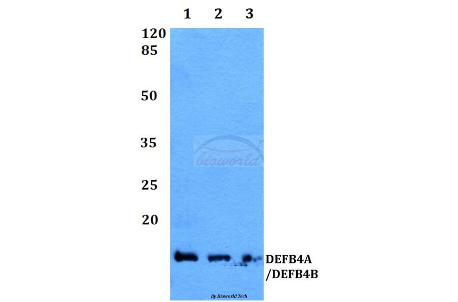 Anti-DEFB4 Antibody from Bioworld Technology (BS60360) - Antibodies.com