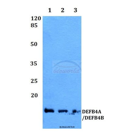 Anti-DEFB4 Antibody from Bioworld Technology (BS60360) - Antibodies.com