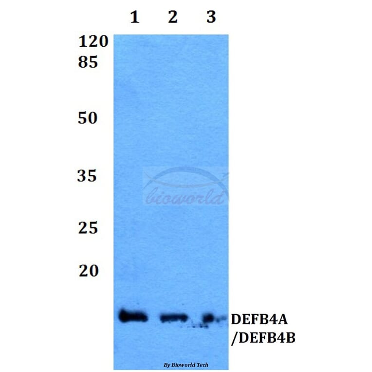 Anti-DEFB4 Antibody from Bioworld Technology (BS60360) - Antibodies.com