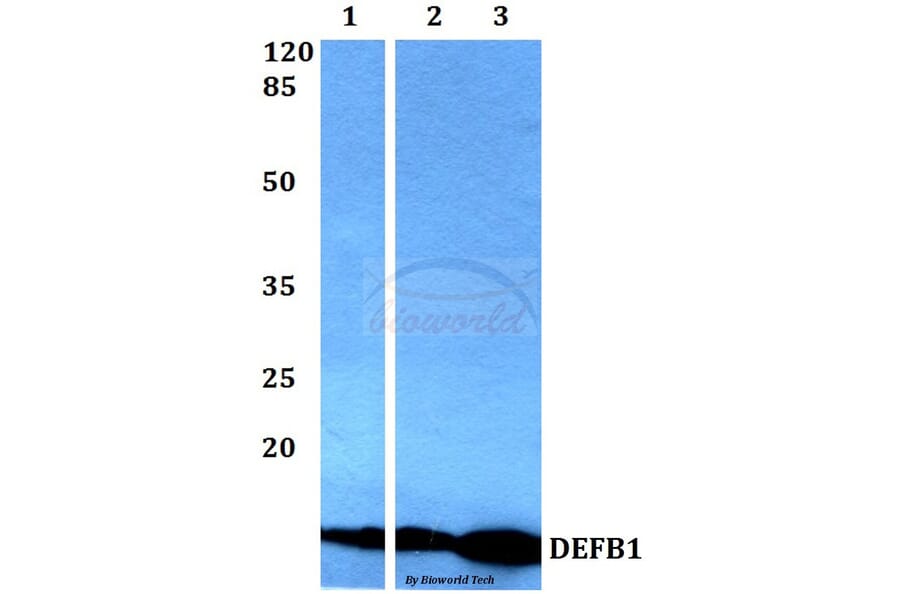 Anti-DEFB1 Antibody from Bioworld Technology (BS60361) - Antibodies.com