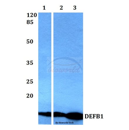 Anti-DEFB1 Antibody from Bioworld Technology (BS60361) - Antibodies.com
