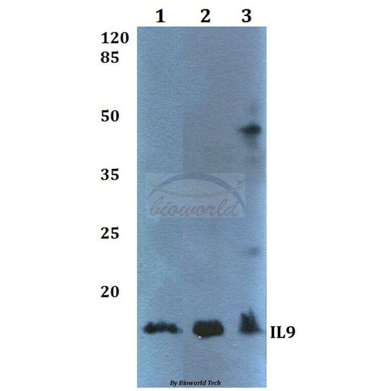 Anti-IL9 Antibody from Bioworld Technology (BS60363) - Antibodies.com