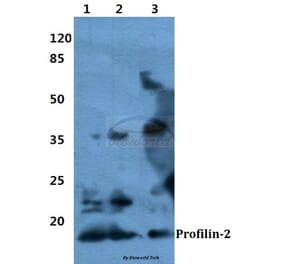 Anti-Profilin-2 Antibody from Bioworld Technology (BS60364) - Antibodies.com
