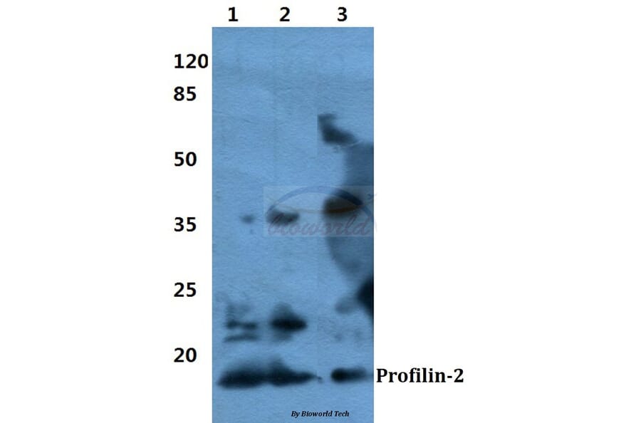 Anti-Profilin-2 Antibody from Bioworld Technology (BS60364) - Antibodies.com