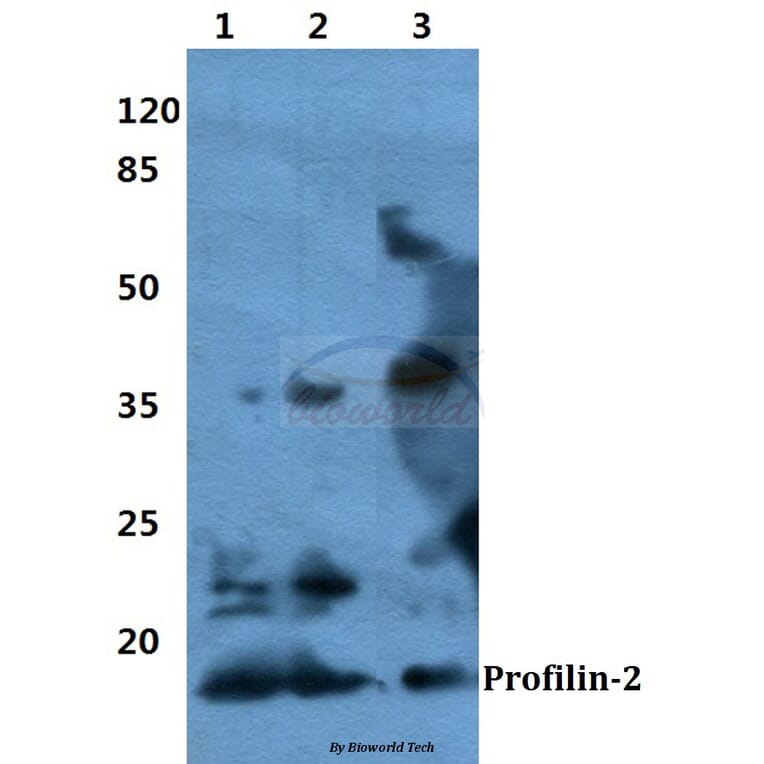 Anti-Profilin-2 Antibody from Bioworld Technology (BS60364) - Antibodies.com