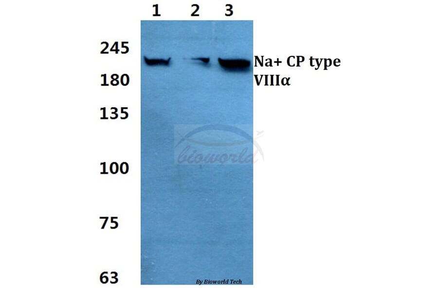 Anti-Na+ CP type VIIIα Antibody from Bioworld Technology (BS60365) - Antibodies.com