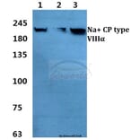 Anti-Na+ CP type VIIIα Antibody from Bioworld Technology (BS60365) - Antibodies.com