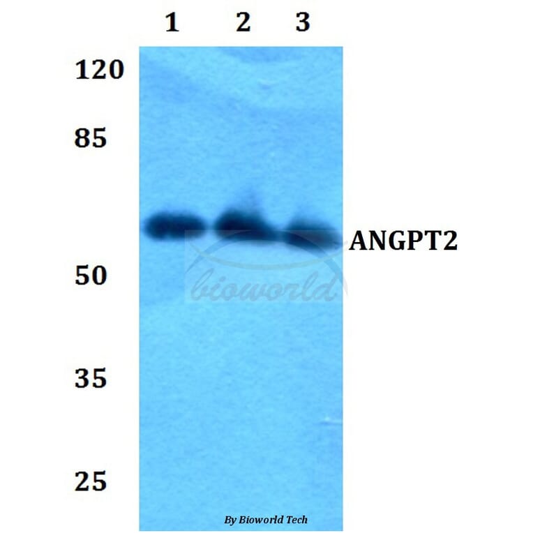 Anti-ANGPT2 Antibody from Bioworld Technology (BS60367) - Antibodies.com