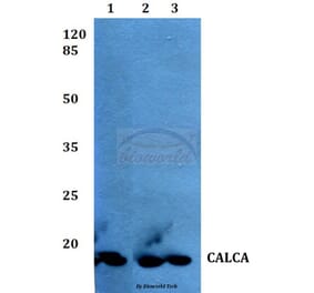 Anti-Calcitonin Antibody from Bioworld Technology (BS60375) - Antibodies.com