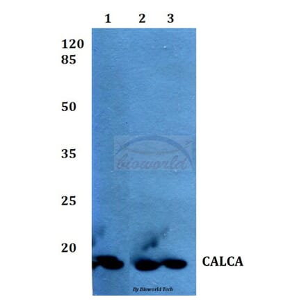 Anti-Calcitonin Antibody from Bioworld Technology (BS60375) - Antibodies.com