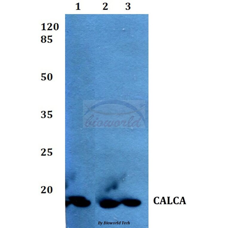 Anti-Calcitonin Antibody from Bioworld Technology (BS60375) - Antibodies.com