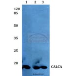 Anti-Calcitonin Antibody from Bioworld Technology (BS60375) - Antibodies.com