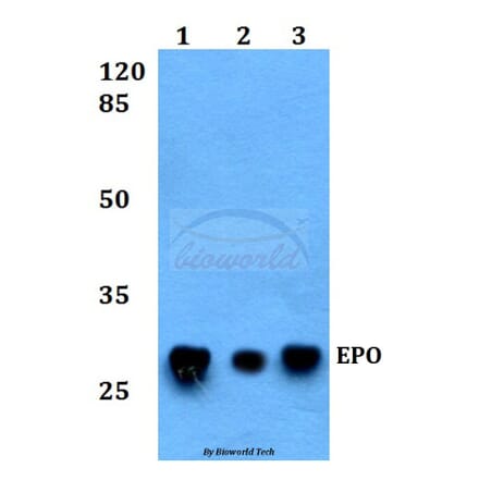 Anti-EPO Antibody from Bioworld Technology (BS60377) - Antibodies.com