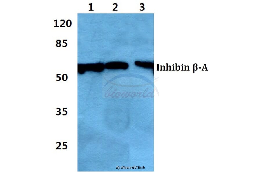 Anti-Inhibin β-A Antibody from Bioworld Technology (BS60379) - Antibodies.com