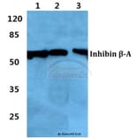 Anti-Inhibin β-A Antibody from Bioworld Technology (BS60379) - Antibodies.com