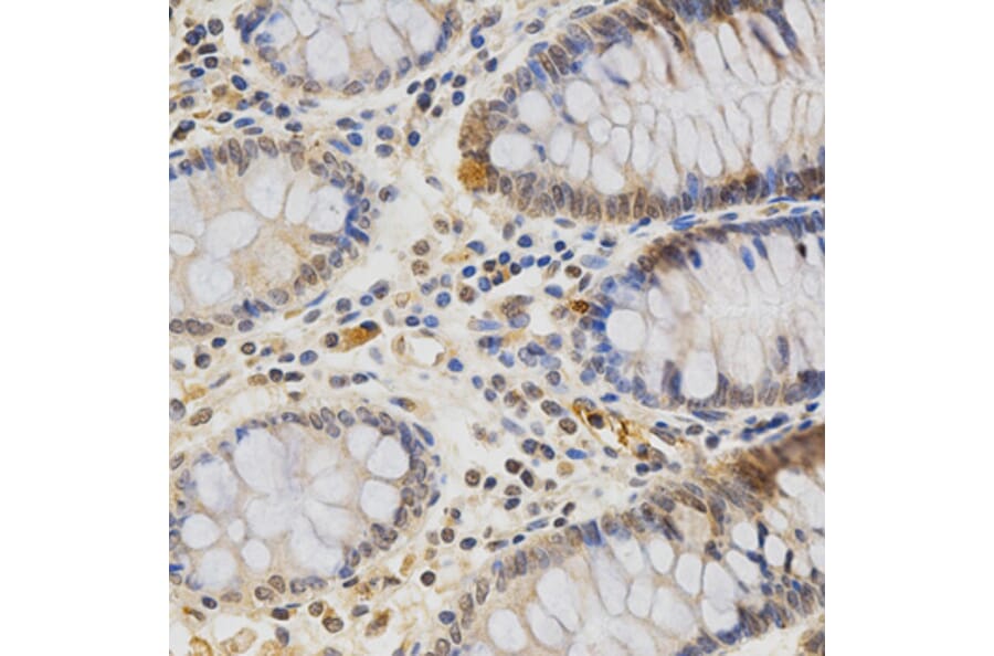 Anti-MDK Antibody from Bioworld Technology (BS6038) - Antibodies.com