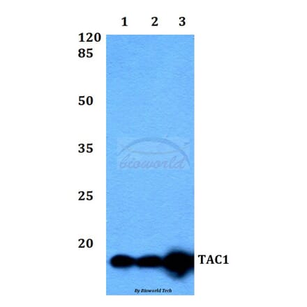 Anti-TAC1 Antibody from Bioworld Technology (BS60380) - Antibodies.com