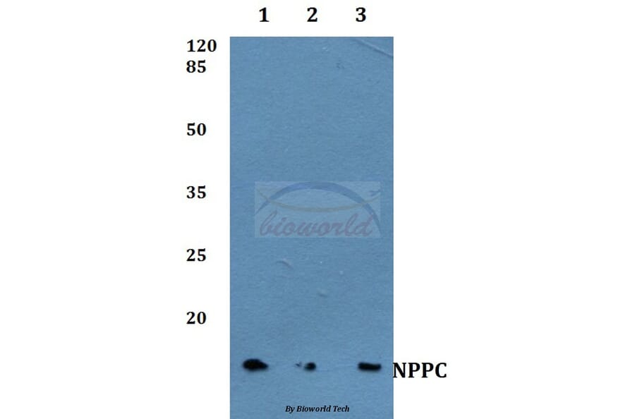 Anti-NPPC Antibody from Bioworld Technology (BS60381) - Antibodies.com