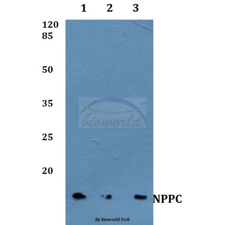 Anti-NPPC Antibody from Bioworld Technology (BS60381) - Antibodies.com