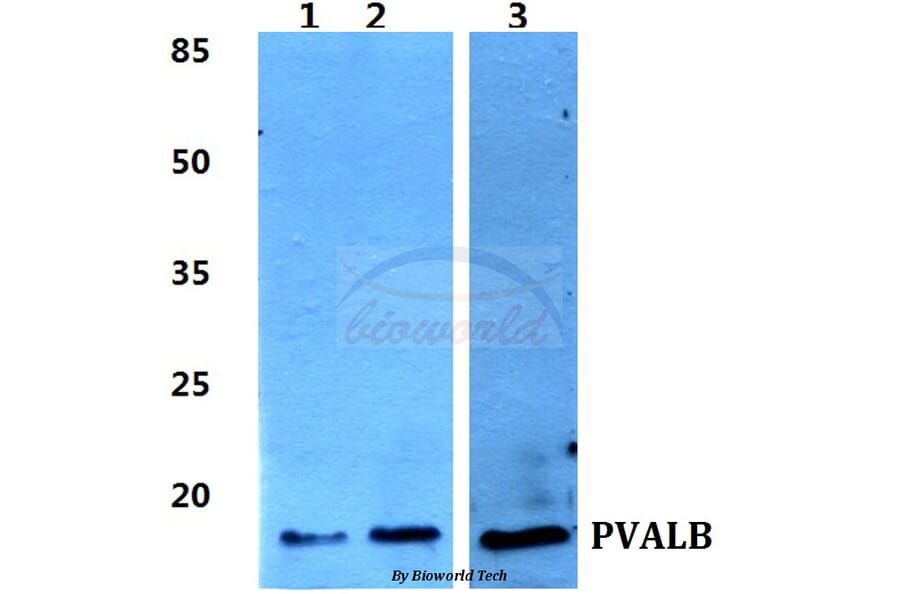 Anti-Parvalbumin α Antibody from Bioworld Technology (BS60382) - Antibodies.com