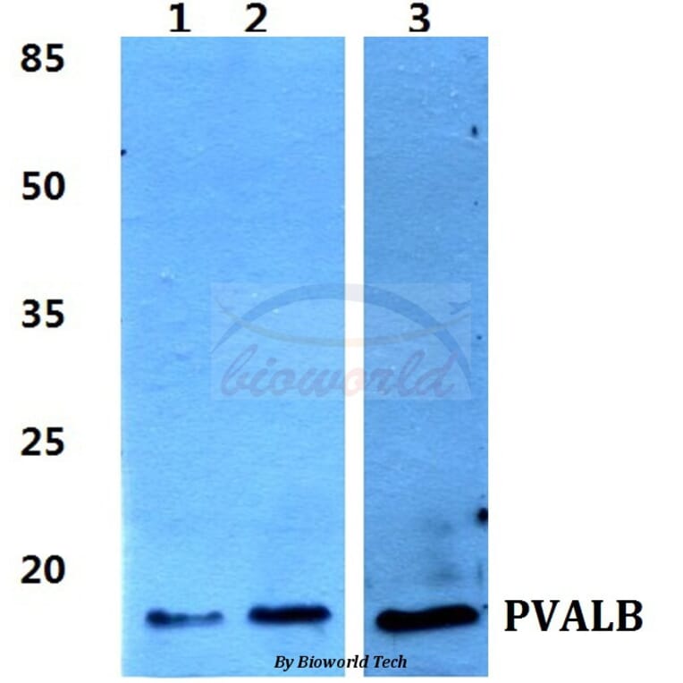 Anti-Parvalbumin α Antibody from Bioworld Technology (BS60382) - Antibodies.com