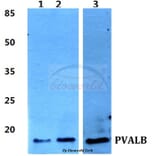 Anti-Parvalbumin α Antibody from Bioworld Technology (BS60382) - Antibodies.com