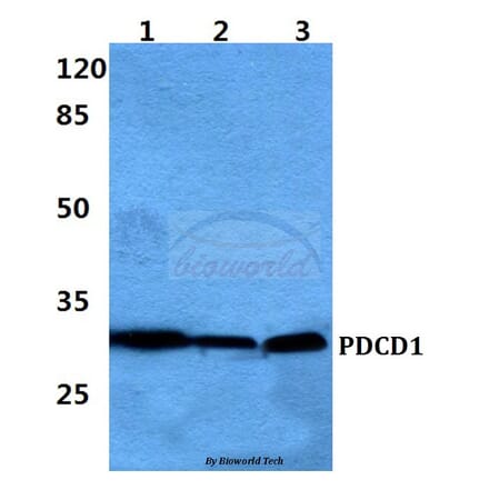 Anti-PDCD1 Antibody from Bioworld Technology (BS60383) - Antibodies.com