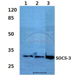 Anti-SOCS-3 Antibody from Bioworld Technology (BS60384) - Antibodies.com