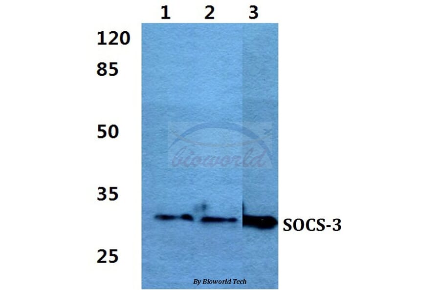 Anti-SOCS-3 Antibody from Bioworld Technology (BS60384) - Antibodies.com