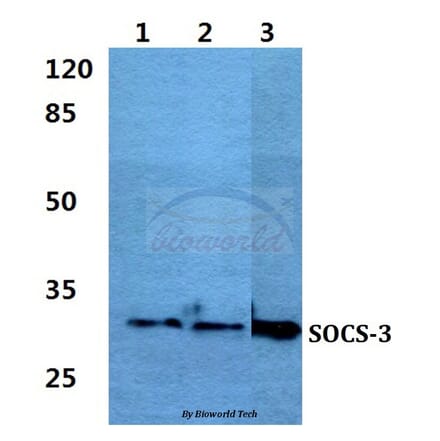 Anti-SOCS-3 Antibody from Bioworld Technology (BS60384) - Antibodies.com
