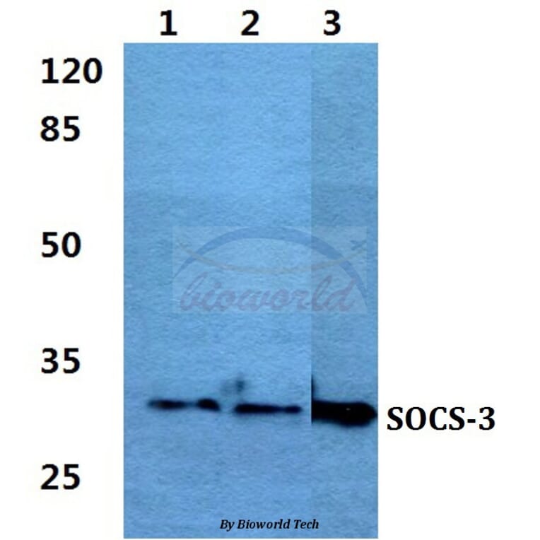 Anti-SOCS-3 Antibody from Bioworld Technology (BS60384) - Antibodies.com