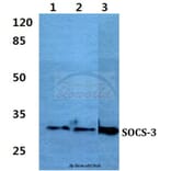 Anti-SOCS-3 Antibody from Bioworld Technology (BS60384) - Antibodies.com