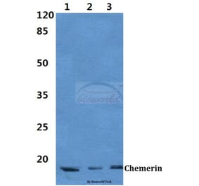 Anti-Chemerin Antibody from Bioworld Technology (BS60386) - Antibodies.com