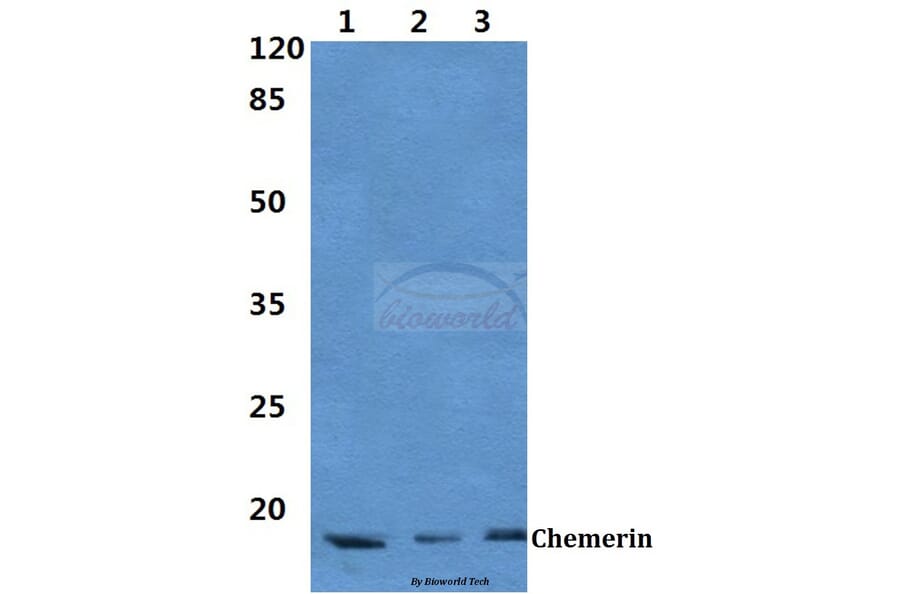 Anti-Chemerin Antibody from Bioworld Technology (BS60386) - Antibodies.com