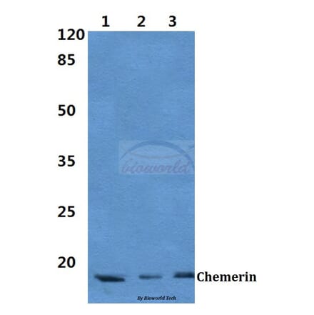 Anti-Chemerin Antibody from Bioworld Technology (BS60386) - Antibodies.com