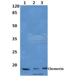 Anti-Chemerin Antibody from Bioworld Technology (BS60386) - Antibodies.com