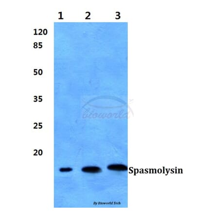 Anti-Spasmolysin Antibody from Bioworld Technology (BS60387) - Antibodies.com