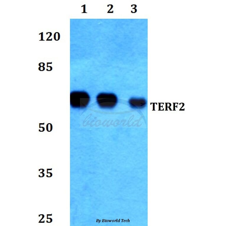 Anti-TERF2 Antibody from Bioworld Technology (BS60388) - Antibodies.com