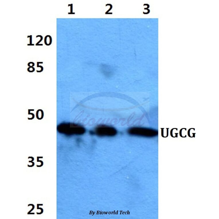 Anti-UGCG Antibody from Bioworld Technology (BS60390) - Antibodies.com