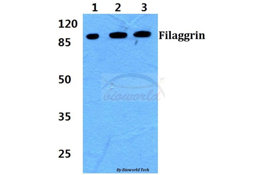 Anti-Filaggrin Antibody from Bioworld Technology (BS60392) - Antibodies.com