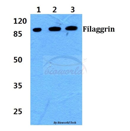 Anti-Filaggrin Antibody from Bioworld Technology (BS60392) - Antibodies.com