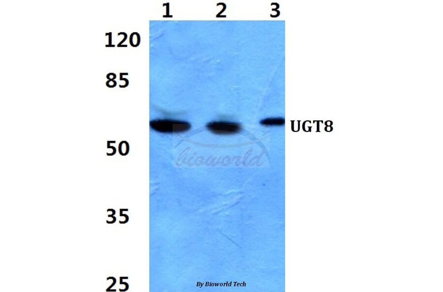 Anti-UGT8 Antibody from Bioworld Technology (BS60393) - Antibodies.com