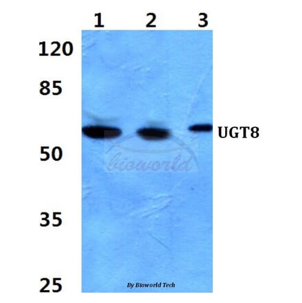 Anti-UGT8 Antibody from Bioworld Technology (BS60393) - Antibodies.com