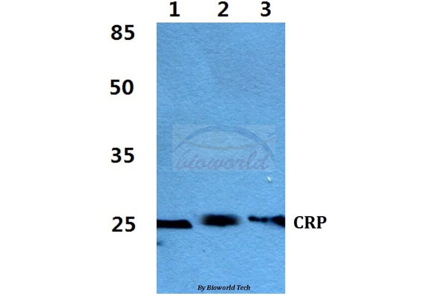 Anti-CRP Antibody from Bioworld Technology (BS60395) - Antibodies.com