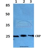 Anti-CRP Antibody from Bioworld Technology (BS60395) - Antibodies.com