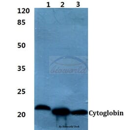 Anti-Cytoglobin Antibody from Bioworld Technology (BS60396) - Antibodies.com