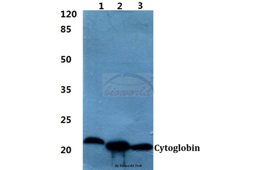 Anti-Cytoglobin Antibody from Bioworld Technology (BS60396) - Antibodies.com