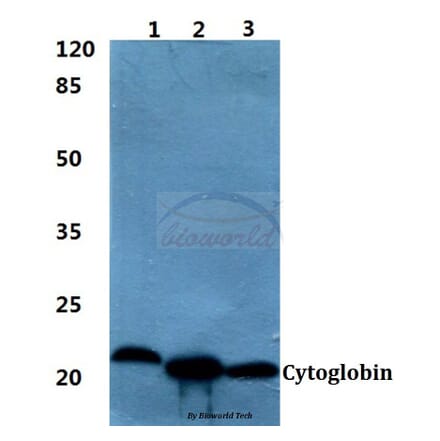 Anti-Cytoglobin Antibody from Bioworld Technology (BS60396) - Antibodies.com