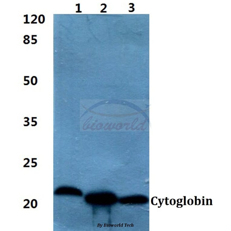 Anti-Cytoglobin Antibody from Bioworld Technology (BS60396) - Antibodies.com